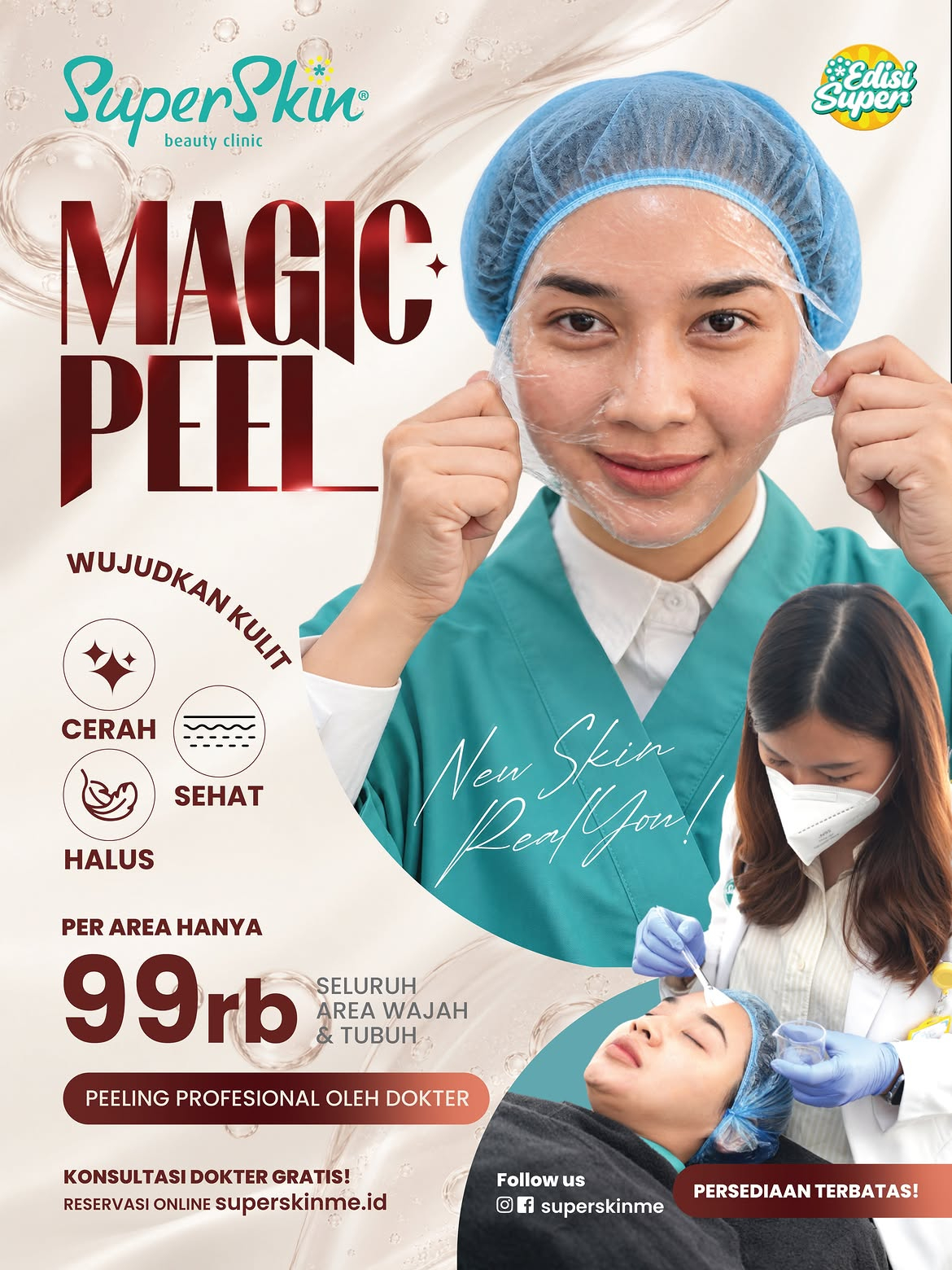 PROMO MAGIC PEEL
